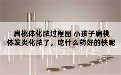 扁桃体化脓过程图 小孩子扁桃体发炎化脓了，吃什么药好的快呢